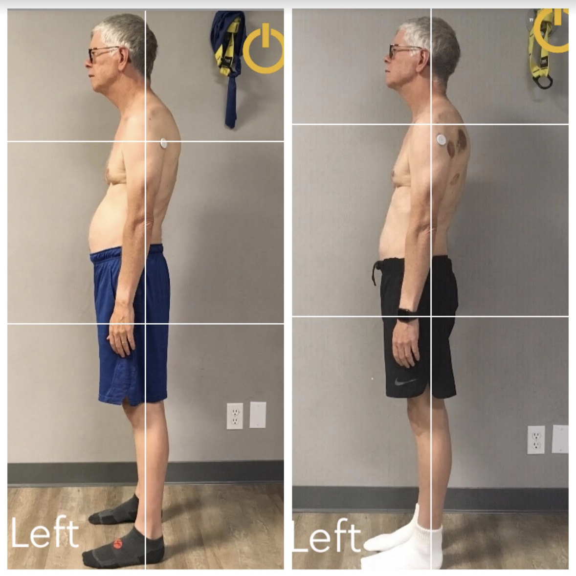 Posture Specialist Sarton Physical Therapy - Egoscue Method